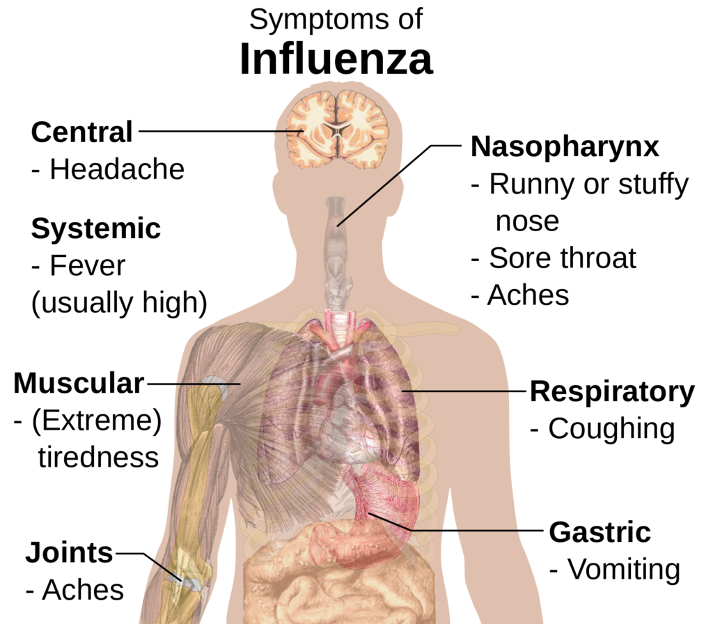 2000px-symptoms_of_influenza-svg